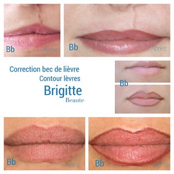 portofolio lèvres contour